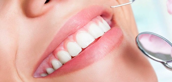Dịch vụ răng sứ thẩm mỹ ngày càng được nhiều người lựa chọn