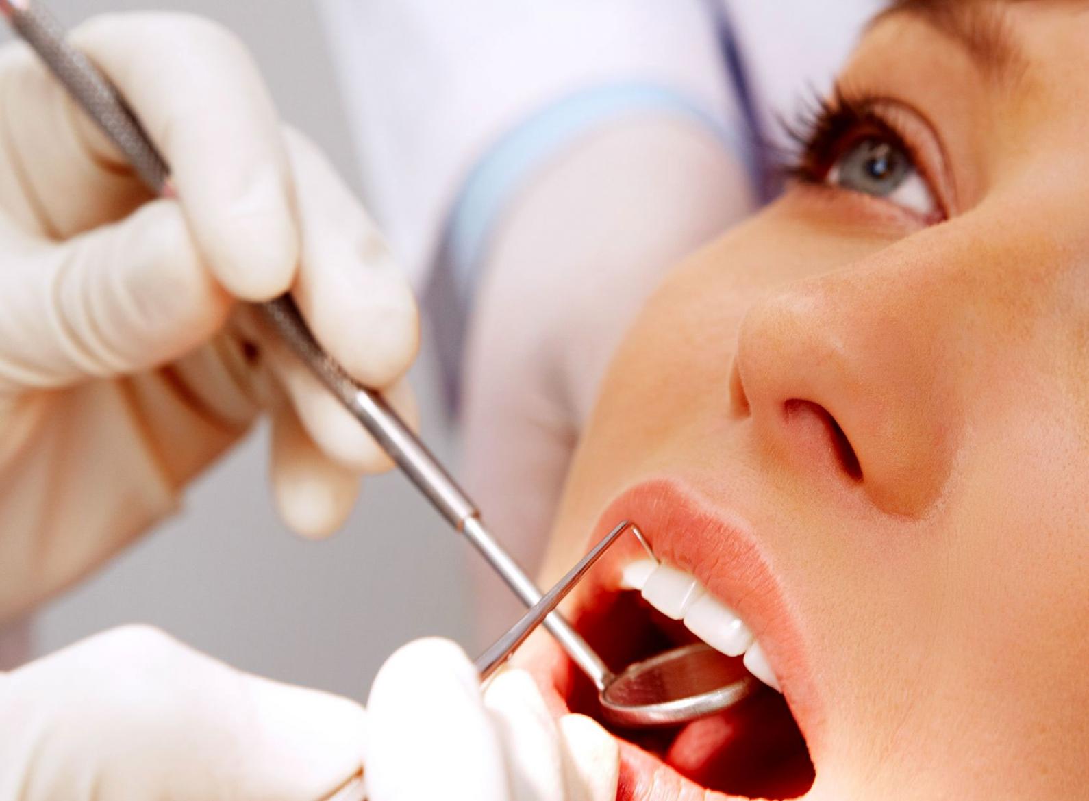 Tẩy trắng răng có có hại tới sức khỏe không?
