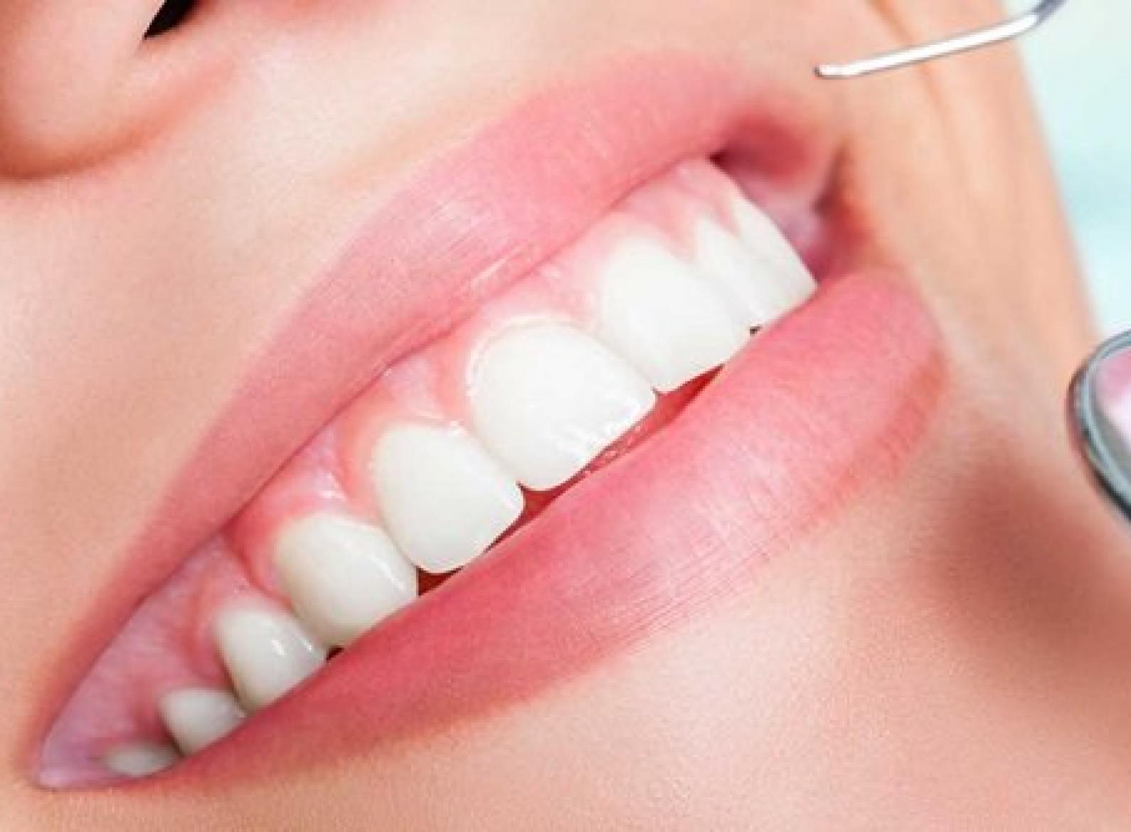 Dịch vụ răng sứ thẩm mỹ ngày càng được nhiều người lựa chọn